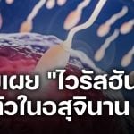 ผลวิจัยพบ ไวรัสฮันตา ฝังตัวในอสุจินาน 6 ปี แม้หายป่วย เสี่ยงติดต่อทางเพศสัมพันธ์