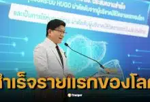 แพทย์ไทยสุดยอด! มช. ผ่าตัดตับด้วยหุ่นยนต์ Hugo™ สำเร็จครั้งแรกของโลก