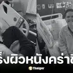 ดาวติ๊กต็อกวัย 25 ปีเสียชีวิตหลังสู้มะเร็งผิวหนัง