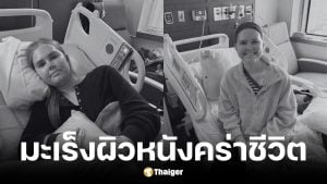 ดาวติ๊กต็อกวัย 25 ปีเสียชีวิตหลังสู้มะเร็งผิวหนัง