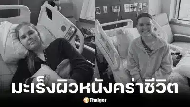 ดาวติ๊กต็อกวัย 25 ปีเสียชีวิตหลังสู้มะเร็งผิวหนัง