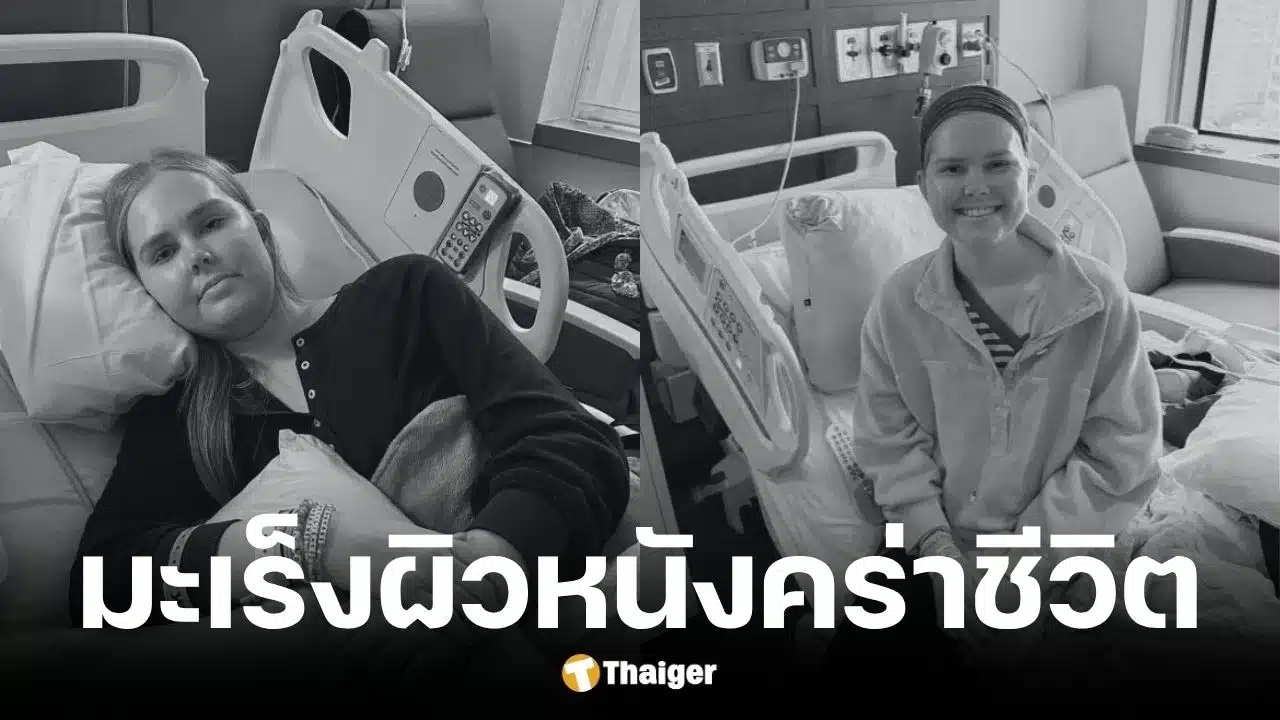 ดาวติ๊กต็อกวัย 25 ปีเสียชีวิตหลังสู้มะเร็งผิวหนัง