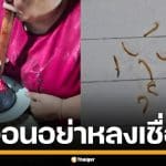 กรมการแพทย์ วอนอย่าหลงเชื่อ วิธีรักษา "แมงกินฟัน" แนะวิธีดูแลฟันอย่างถูกต้อง