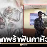 คลิปคนเหล็กอินเดีย ถูกพร้าฟันคาหัว เดินเข้าไอซียู เล่นมือถือตาเฉย