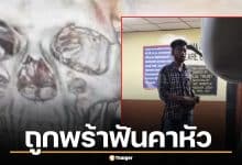 คลิปคนเหล็กอินเดีย ถูกพร้าฟันคาหัว เดินเข้าไอซียู เล่นมือถือตาเฉย