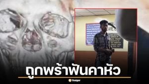 คลิปคนเหล็กอินเดีย ถูกพร้าฟันคาหัว เดินเข้าไอซียู เล่นมือถือตาเฉย