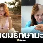 ติ๊กต็อกเกอร์เวียดนามโกนหัวรักษามะเร็งเม็ดเลือดขาว