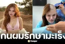 ติ๊กต็อกเกอร์เวียดนามโกนหัวรักษามะเร็งเม็ดเลือดขาว