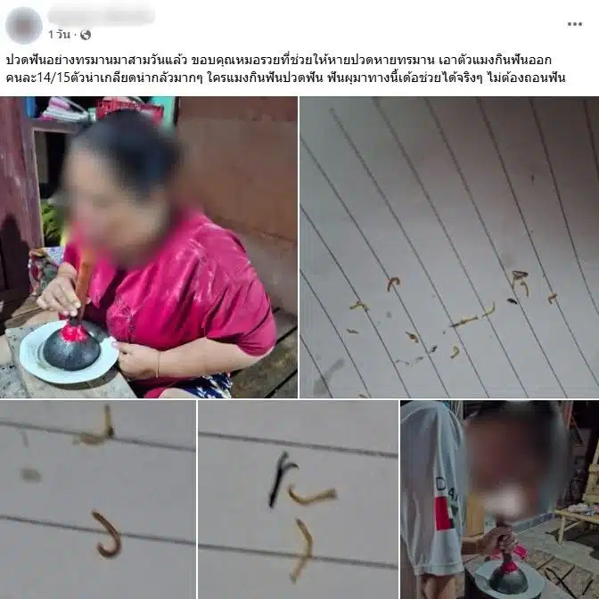 การรักษาฟันผุด้วยการรมมควัน
