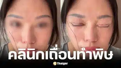 สาวจีนทำตาสองชั้นตาปิดไม่สนิท มีน้ำตาไหลตลอดเวลา