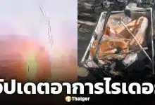 อาการล่าสุด ไรเดอร์ถูกฟ้าผ่า ทีมแพทย์เตรียมทำเอกซเรย์และสแกนสมอง