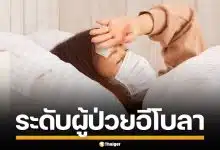 กรมควบคุมโรค เผย 3 ระดับผู้ป่วย "อีโบลา" รับมือเฝ้าระวัง หลังบราซิลพบเคสเสี่ยง