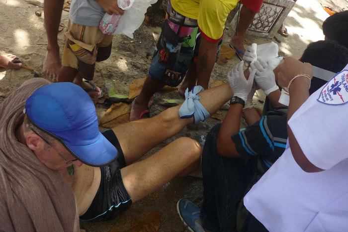 Phuket beach tear-down debris stabs tourist through foot