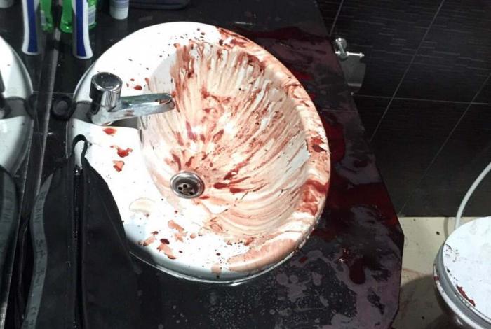 Patong hotel staff walk into bloodbath