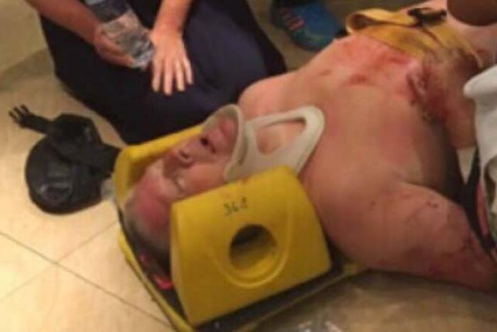 Aussie survives Phuket balcony fall