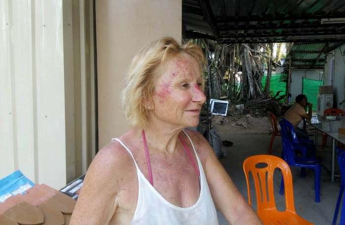 French pensioner mugged by Phuket ‘teenage’ thugs