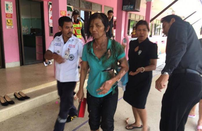 Phuket woman set on fire, ex-husband wanted by police