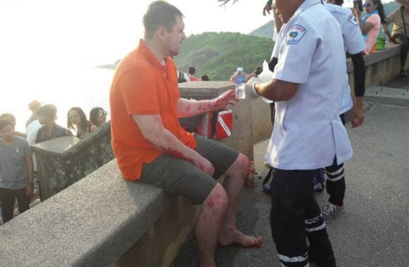 Russian tourist injured after falling off Phuket’s Promthep Cape