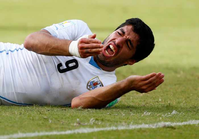 Bite set to eat into Suarez’s sponsorship cash