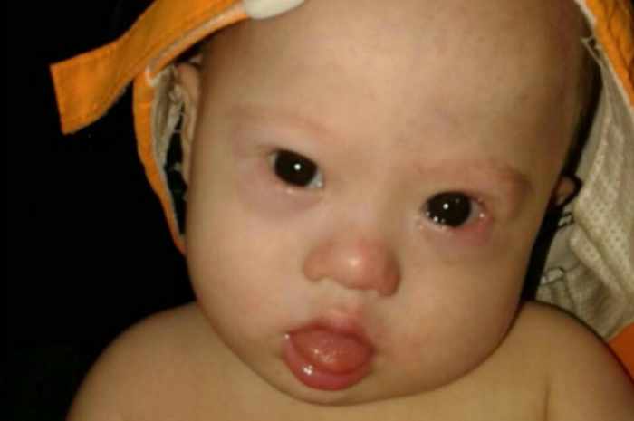 Mother warns against surrogacy as donations pour in for Down syndrome baby