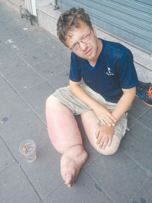 Tourist Police, charity rescue German beggar