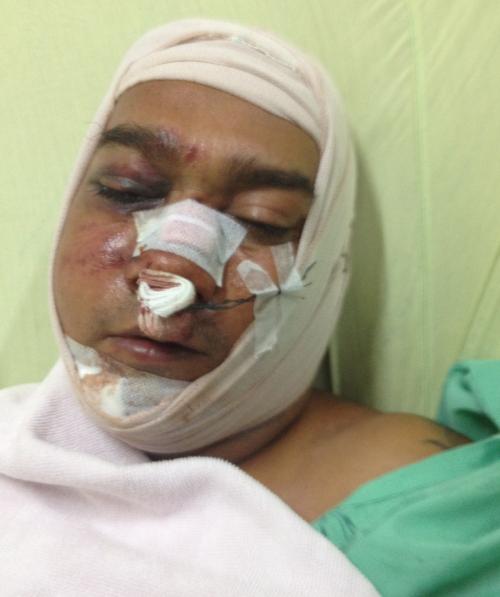 Phuket hospital confirms identity of severely beaten Nepalese tailor