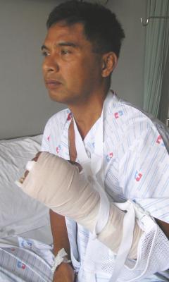 Patong politician attacked with metal bar