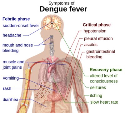 Phuket Media Watch – dengue outbreak; alcohol update; New York woman crushed by lift