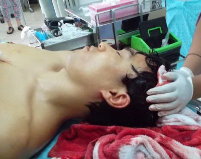 Korean tourist survives gash in head from longtail propeller