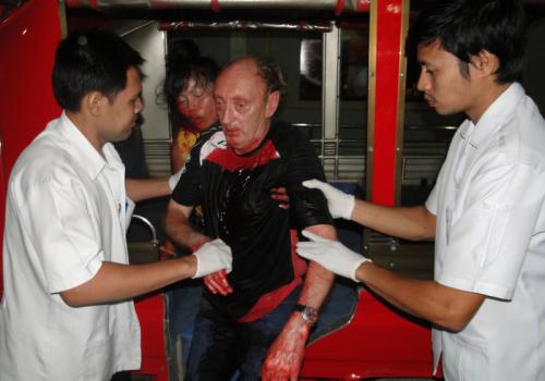 Belgian expat stabbed by Thai girlfriend out of Phuket ICU