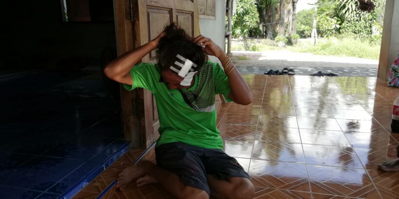 เท้าแชร์โหด ต่อยลูกแชร์ หน้ายับ กลางตลาดนัด เหตุไม่พอใจถูกทวงเงินค่าแชร์ | The Thaiger