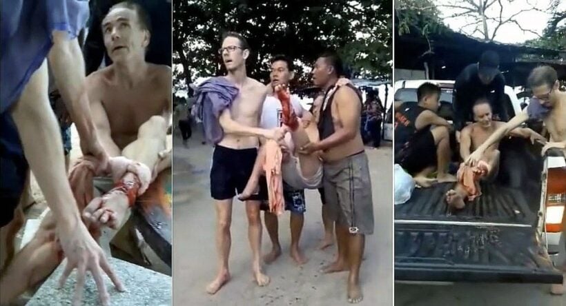 Thai Tourism Ministry pays 66,000 baht to Norwegian shark attack victim