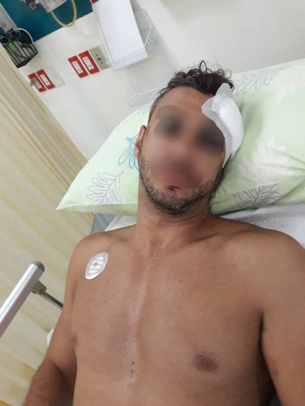 Israeli tourist injured after attack by Krabi man