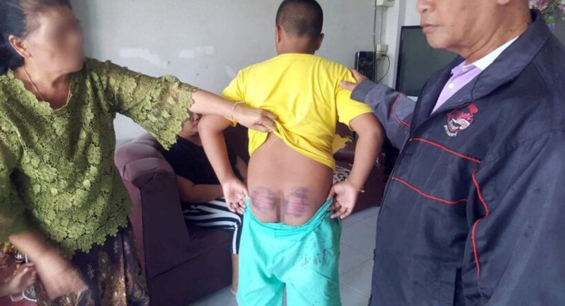 Buri Ram teacher probed after boy’s beating