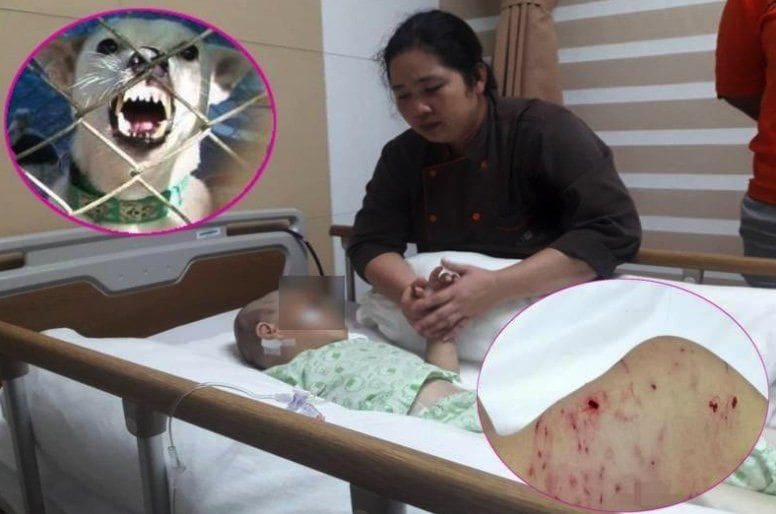 Three year old savaged by local dogs in Chon Buri