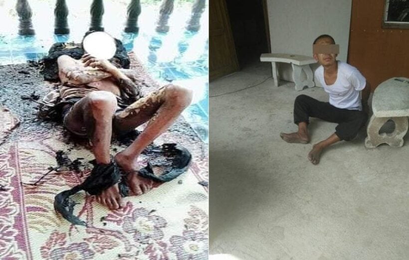 ชาวบ้านวอนประหารลูกทรพีเมา ราดน้ำมันจุดไฟเผาพ่อบังเกิดเกล้า! อาการยังโคม่าทรมาน | The Thaiger