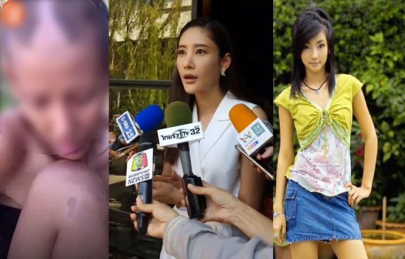 “แตงโม” เยี่ยม “ต่าย มนัสนันท์” ชีวิตพลิกผันเร่ร่อน โล่งใจถึงมือหมอแล้ว | The Thaiger