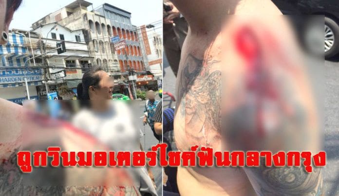 วินมอเตอร์ไซค์ข้าวสาร ฟันโหดแกร็บไบค์ แผลไหล่เหวอะสุดสยอง | The Thaiger