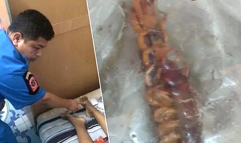 Nakorn Pathom woman dies after centipede bite