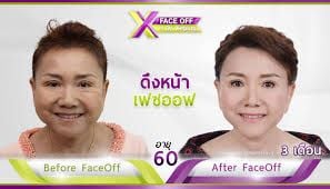 Losing face: 'Face Off' Dr Xeping charged with fraud | News by Thaiger