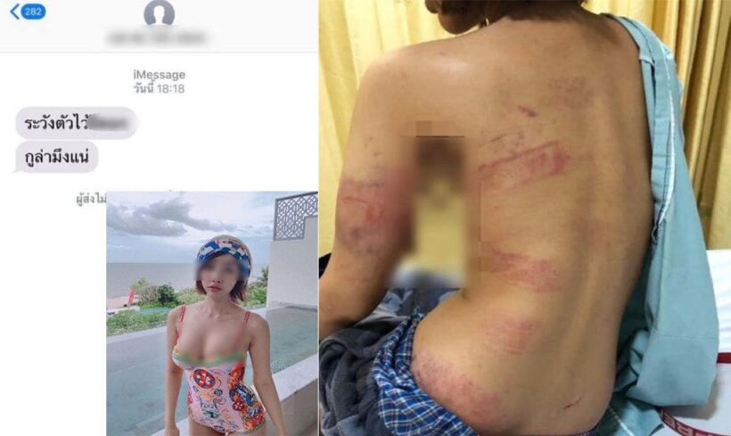 ชาวเน็ตแห่แชร์ เน็ตไอดอลสาวถูกแฟนหนุ่มซ้อมปางตาย ลามไปขู่ยันแม่ | The Thaiger