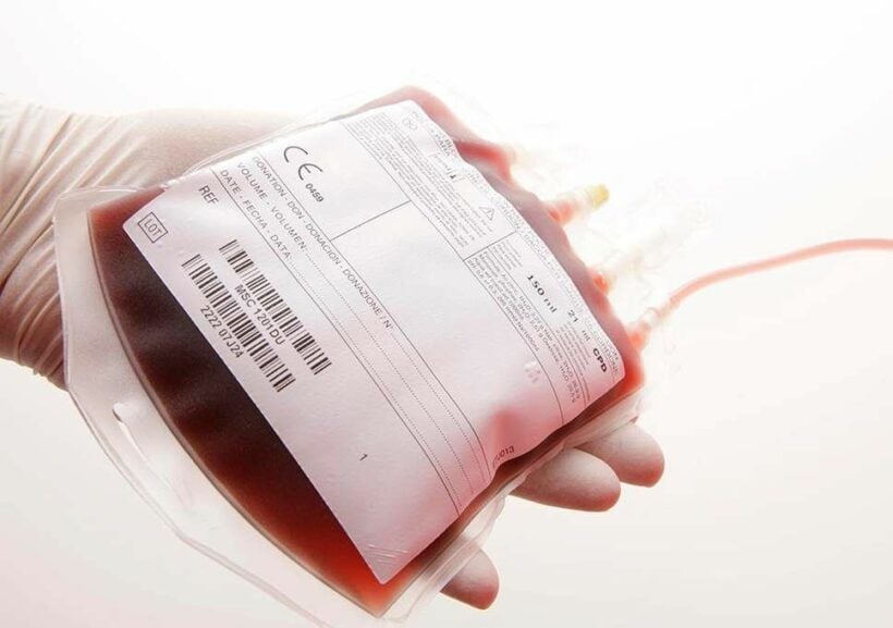 Patient reveals he contracted HIV from donated blood