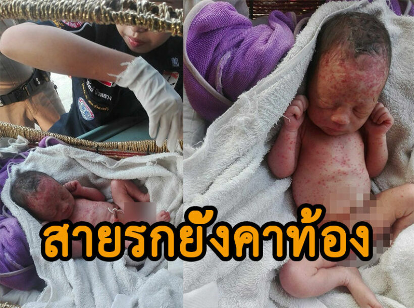 แม่ใจมาร ทิ้งลูกเกิดได้เพียง 1 วัน ยุงรุมกัดแดงทั้งตัว รอความตาย | The Thaiger
