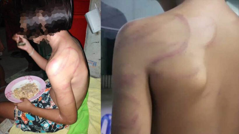 ปู่พาหลานวัย 10 ขวบเข้าแจ้งความ สุดทนพฤติกรรมพ่อเด็กทำร้ายร่างกาย | The Thaiger