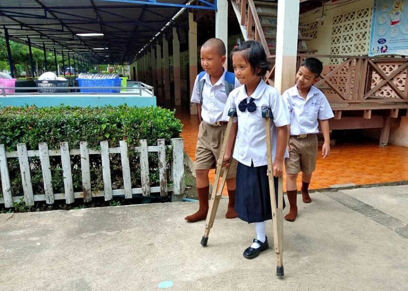 Nattaporn needs you help – nine year old Thai amputee wants a prosthetic leg