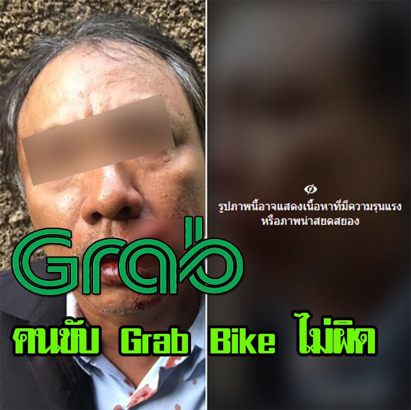 Grabแจง หนุ่มแกร็บไบก์โดนวินทำร้ายปากฉีก คนขี่แกร็บไม่ผิด | The Thaiger
