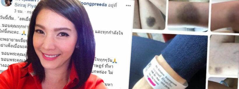 เผยแล้ว นิ้ง กุลสตรี เป็นโรคอะไร หลังพบรอยช้ำทั่วตัวอย่างไร้สาเหตุ | The Thaiger