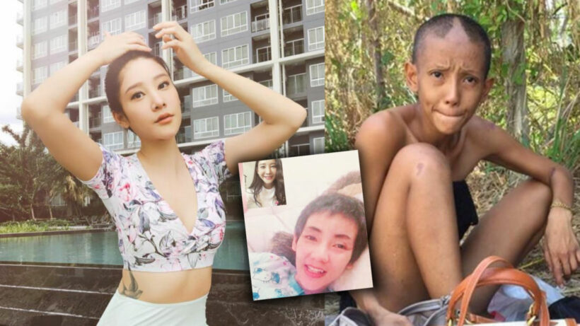 แตงโม นิดา โพสต์ภาพอัพเดตอาการ ต่าย มนัสนันท์ หน้าตายิ้มแย้มสดใสขึ้น | The Thaiger
