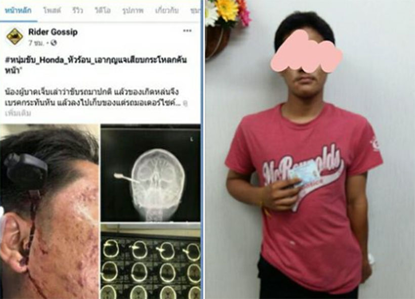 รวบตัวหนุ่มหัวร้อน ต่อยคู่กรณี กุญแจรถเสียบทะลุขมับ ฉุนเบรกกะทันหัน | The Thaiger