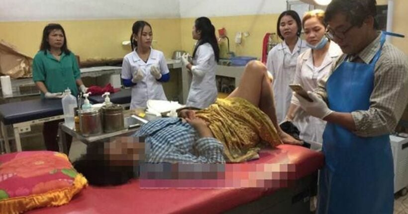 Bangkok woman hospitalised after she falls over and a cucumber ended up inside her